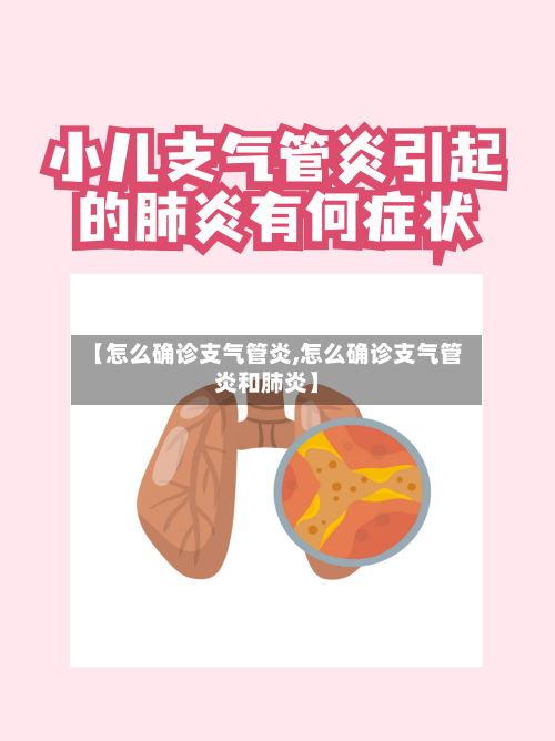 【怎么确诊支气管炎,怎么确诊支气管炎和肺炎】
