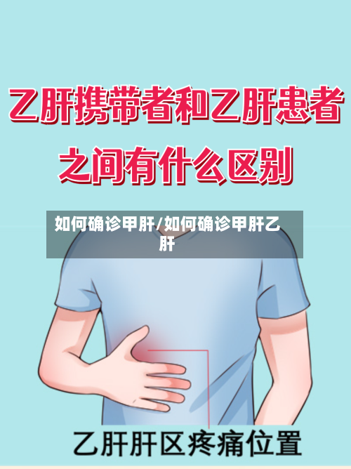 如何确诊甲肝/如何确诊甲肝乙肝-第2张图片