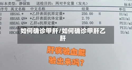如何确诊甲肝/如何确诊甲肝乙肝-第3张图片