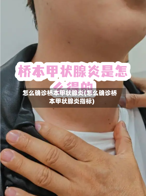 怎么确诊桥本甲状腺炎(怎么确诊桥本甲状腺炎指标)-第2张图片