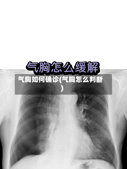 气胸如何确诊(气胸怎么判断)