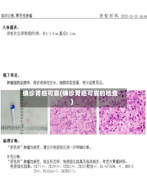 确诊胃癌可靠(确诊胃癌可靠的检查)-第3张图片