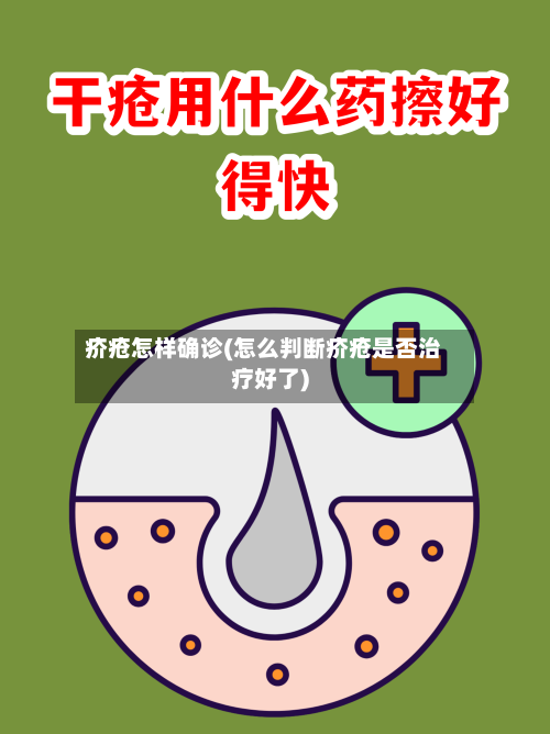 疥疮怎样确诊(怎么判断疥疮是否治疗好了)