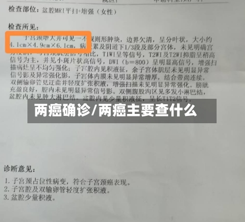 两癌确诊/两癌主要查什么-第3张图片