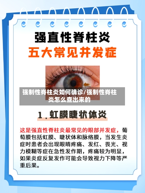 强制性脊柱炎如何确诊/强制性脊柱炎怎么查出来的