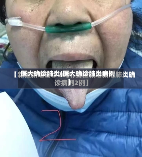 医大确诊肺炎(医大确诊肺炎病例)-第3张图片