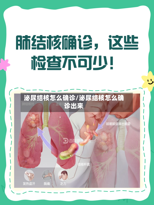 泌尿结核怎么确诊/泌尿结核怎么确诊出来