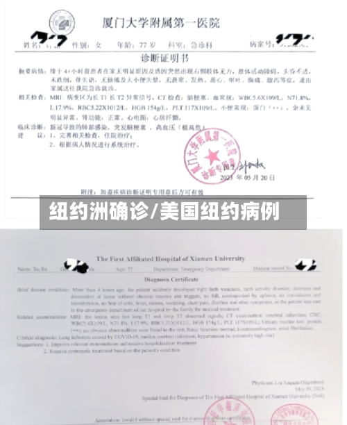 纽约洲确诊/美国纽约病例