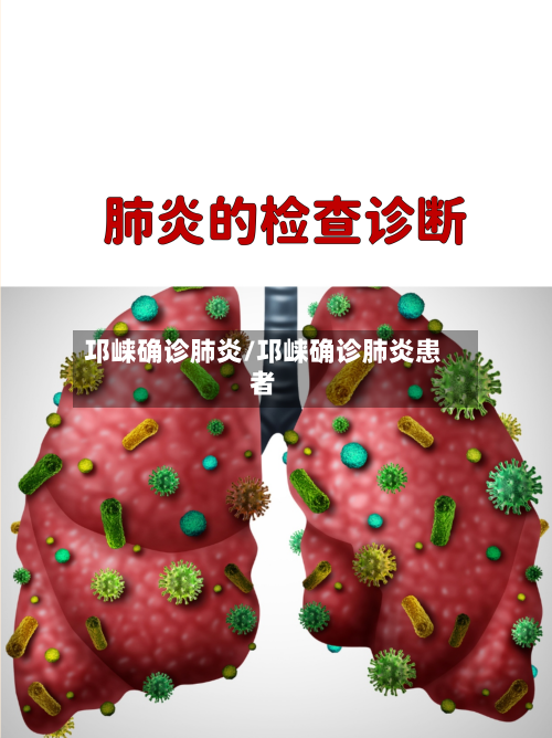 邛崃确诊肺炎/邛崃确诊肺炎患者